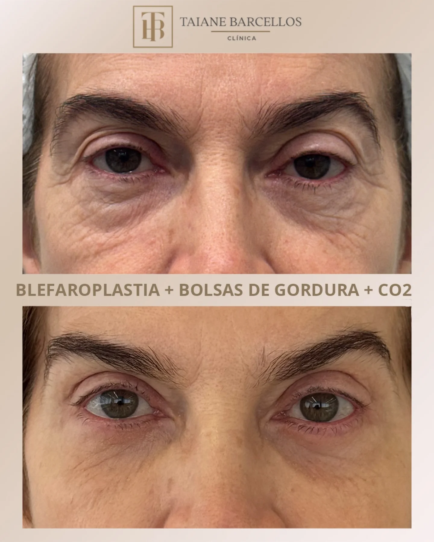 Dra. Taiane Barcellos Facebook ad