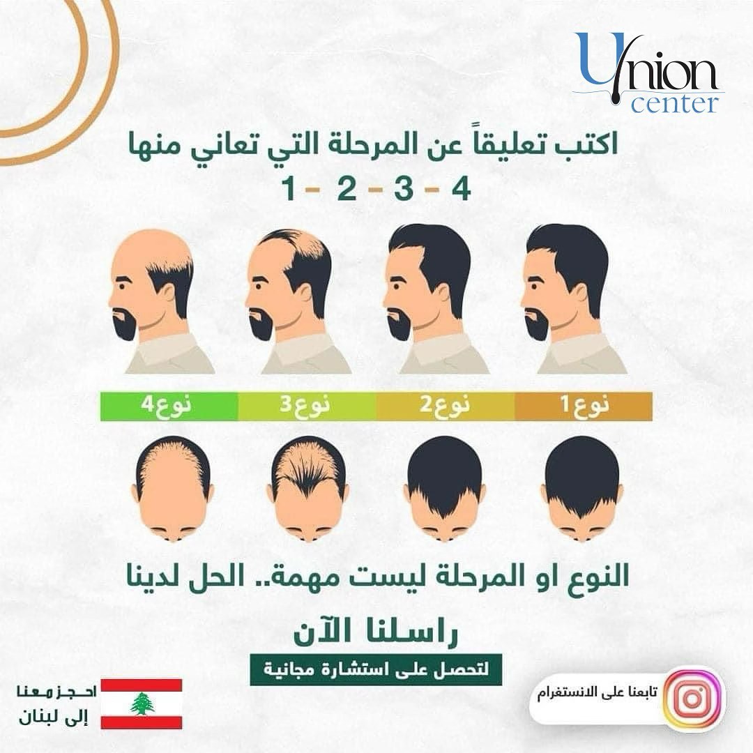 Union centers Facebook ad: Union Center Hair transplant 50% Offers
