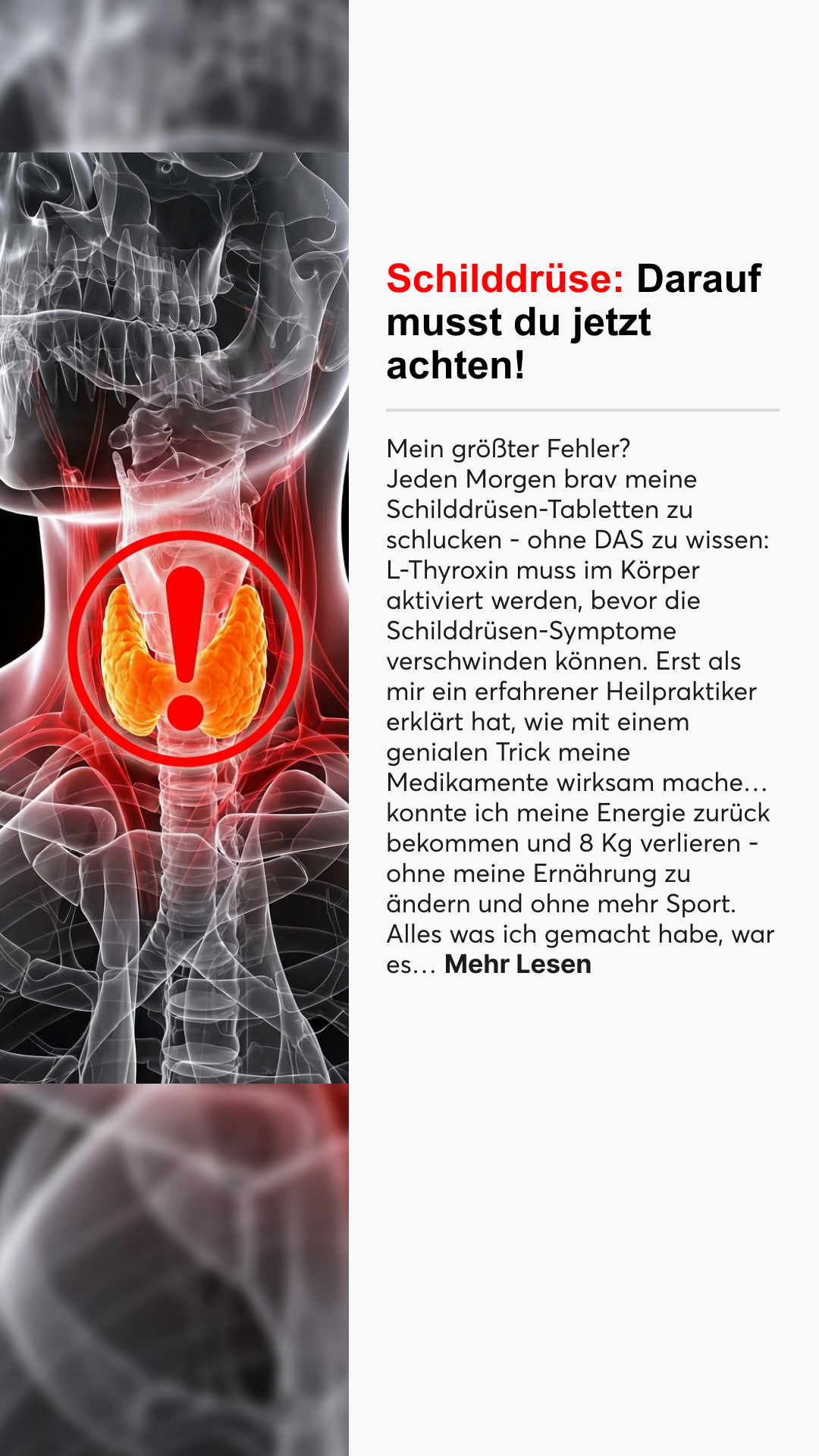 Mission Schilddrüse Facebook ad