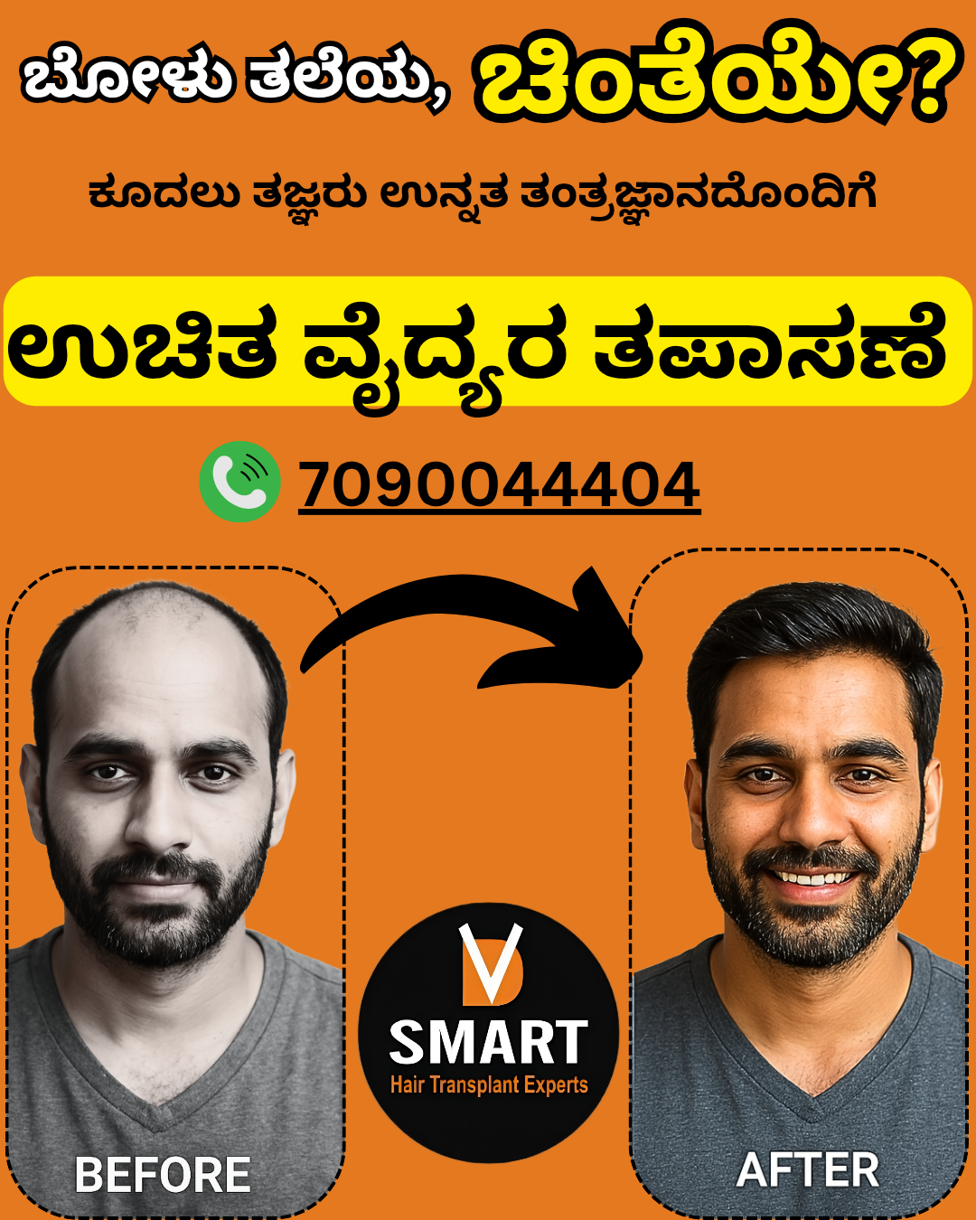 V-Smart Hair Transplant & Skin Solutions Facebook ad