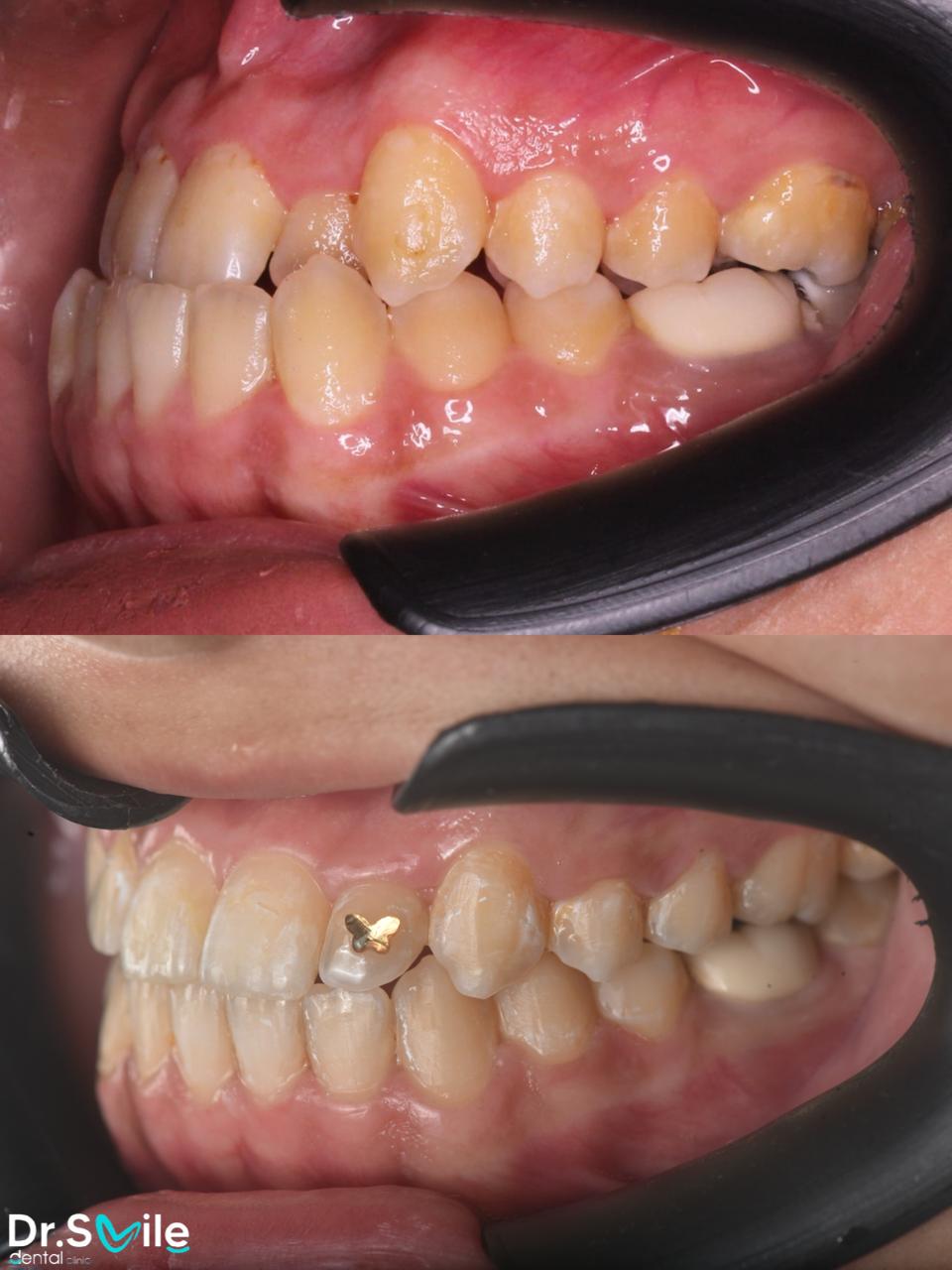 Dr.Smile Dental Clinic - لزراعة وتجميل الأسنان Facebook ad