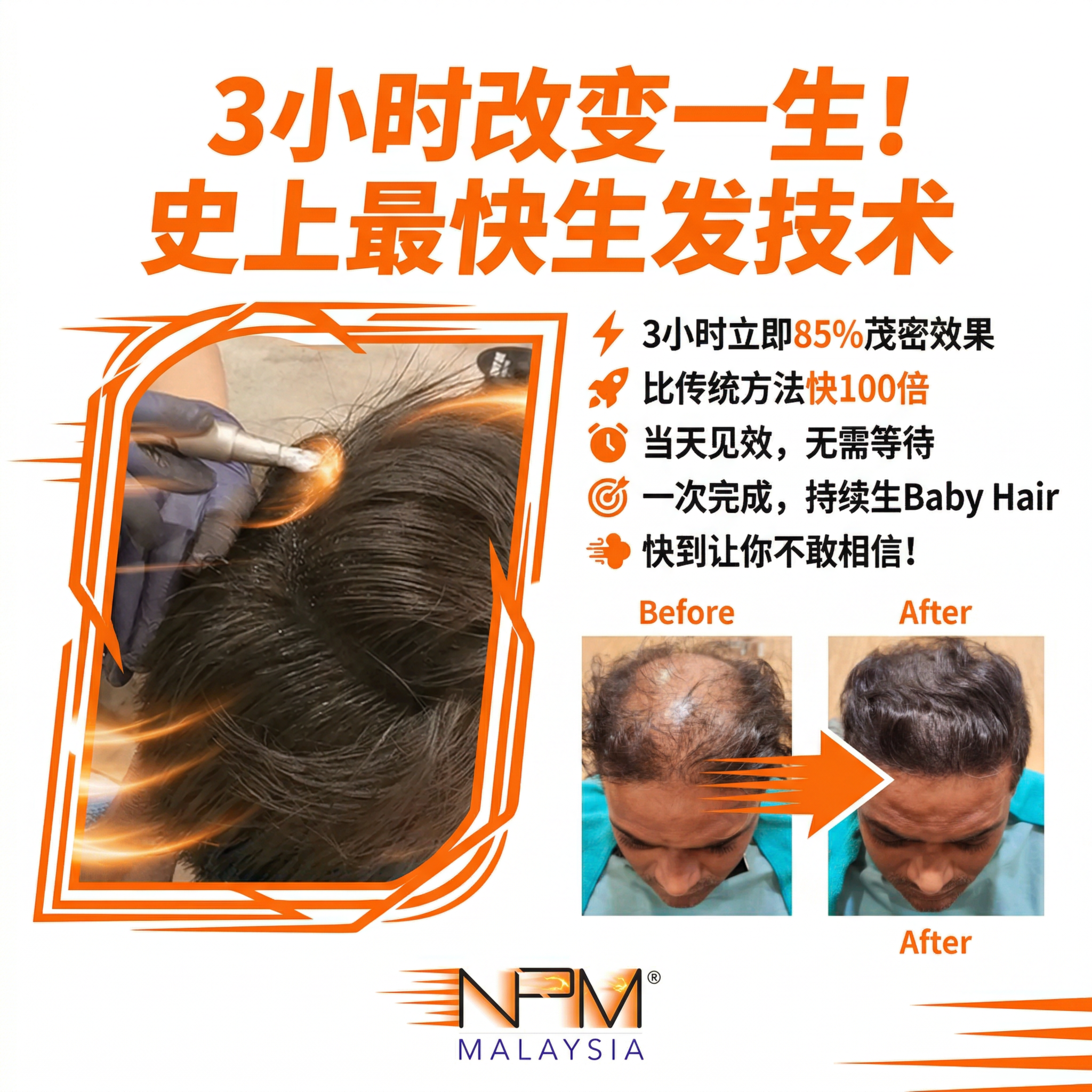 NPM Malaysia Facebook ad: 别再苦等 6 个月了!史上最快的3小时生发黑科技强势登陆全马!如果有一种技术,能让你在 3个小时内…