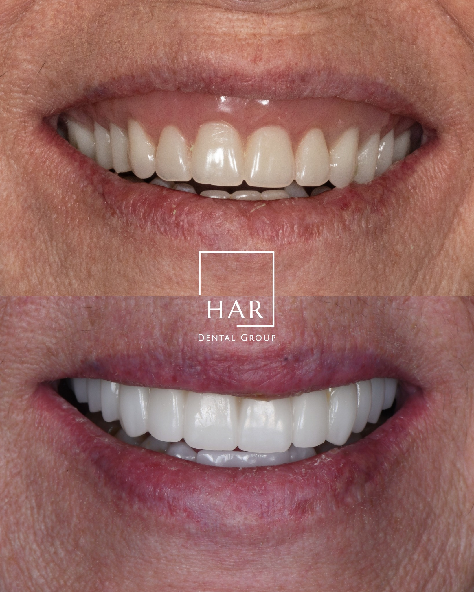 Amarillo Dental & Implant Center Facebook ad