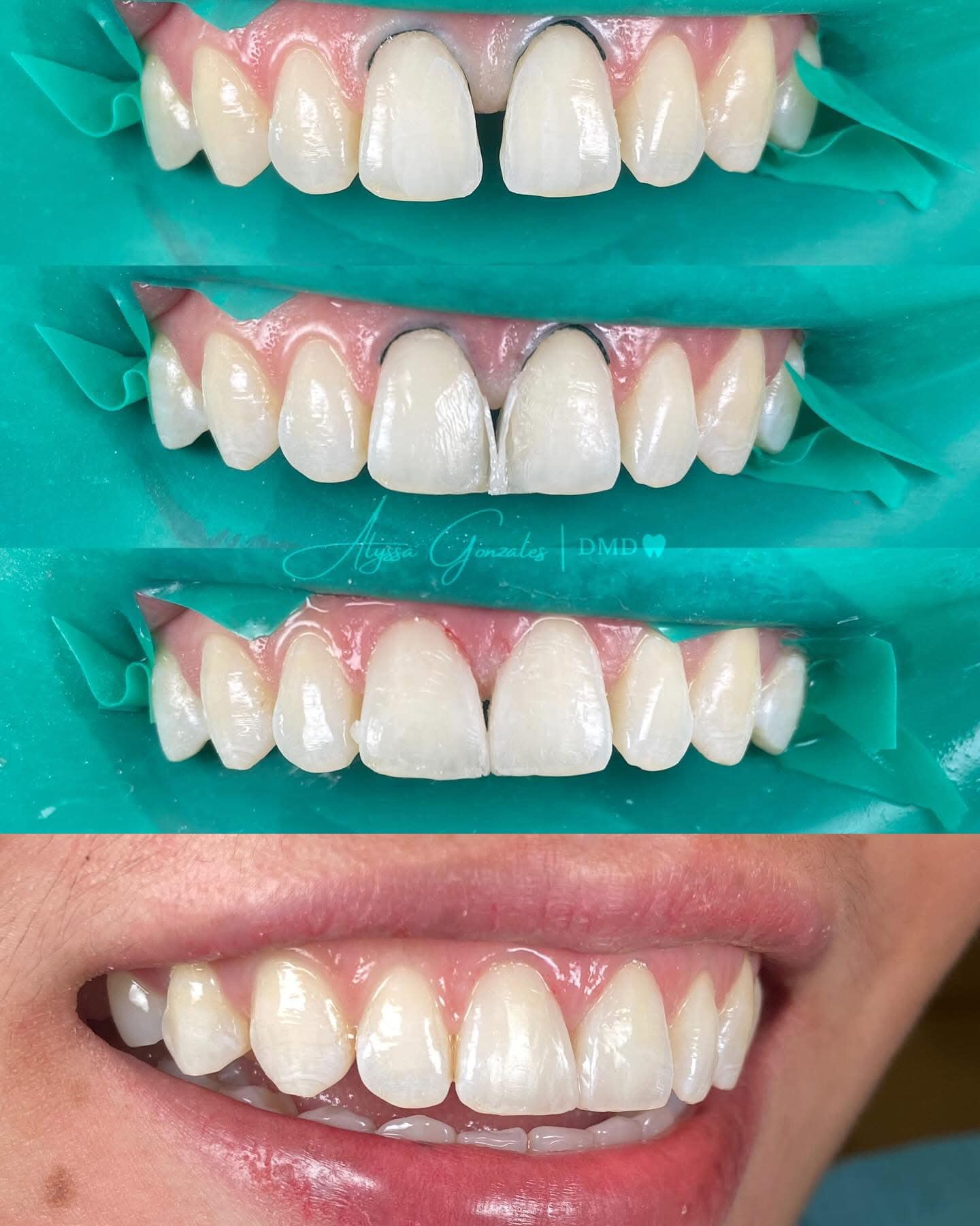 Gonzales Dental Clinic - Matina Facebook ad