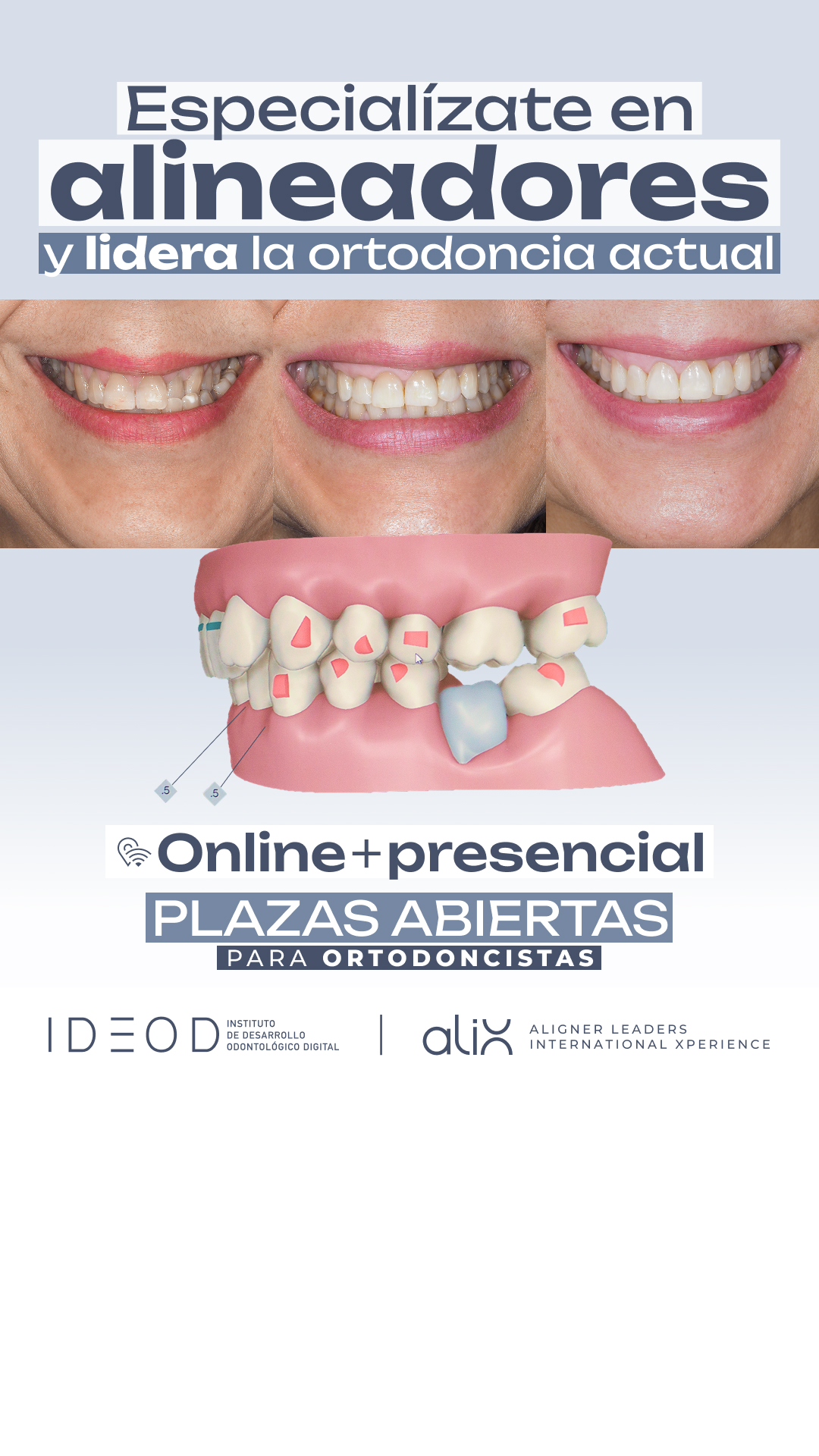 Instituto IDEOD Facebook ad: Especialízate en ortodoncia con alineadores
