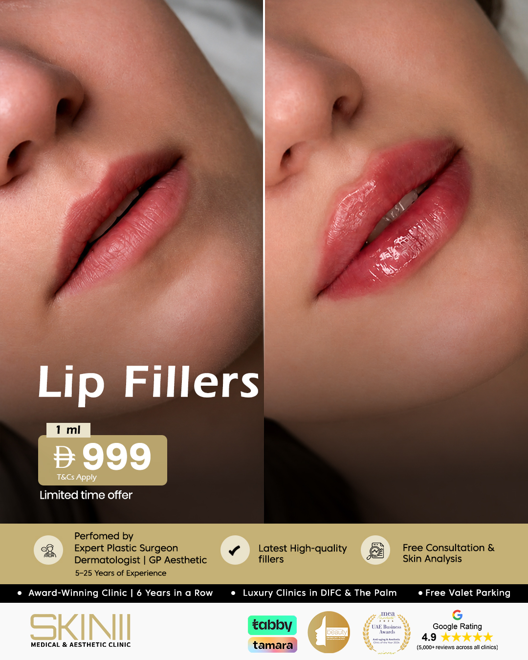Skin111 Clinics Facebook ad: Your perfect lips start here