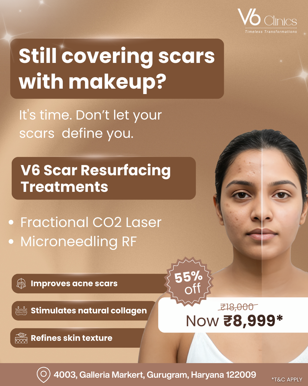 V6 Clinics Facebook ad: Say Goodbye to Acne Scars @ ₹8,999