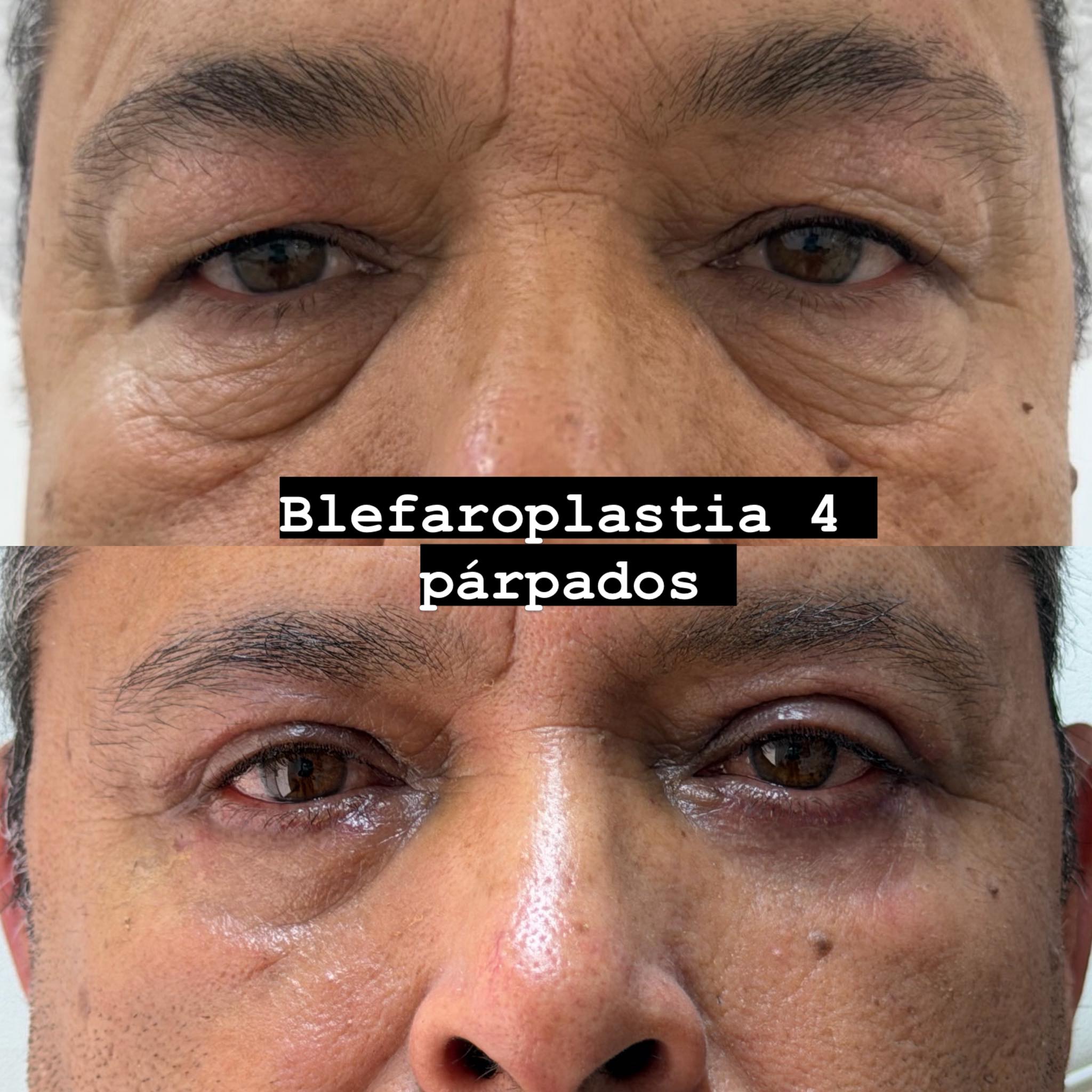 Dra. Verónica Balderrama Oftalmólogo/ Oculoplástico Facebook ad