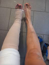 Nicole Parker Facebook ad: Relieve swelling, naturally