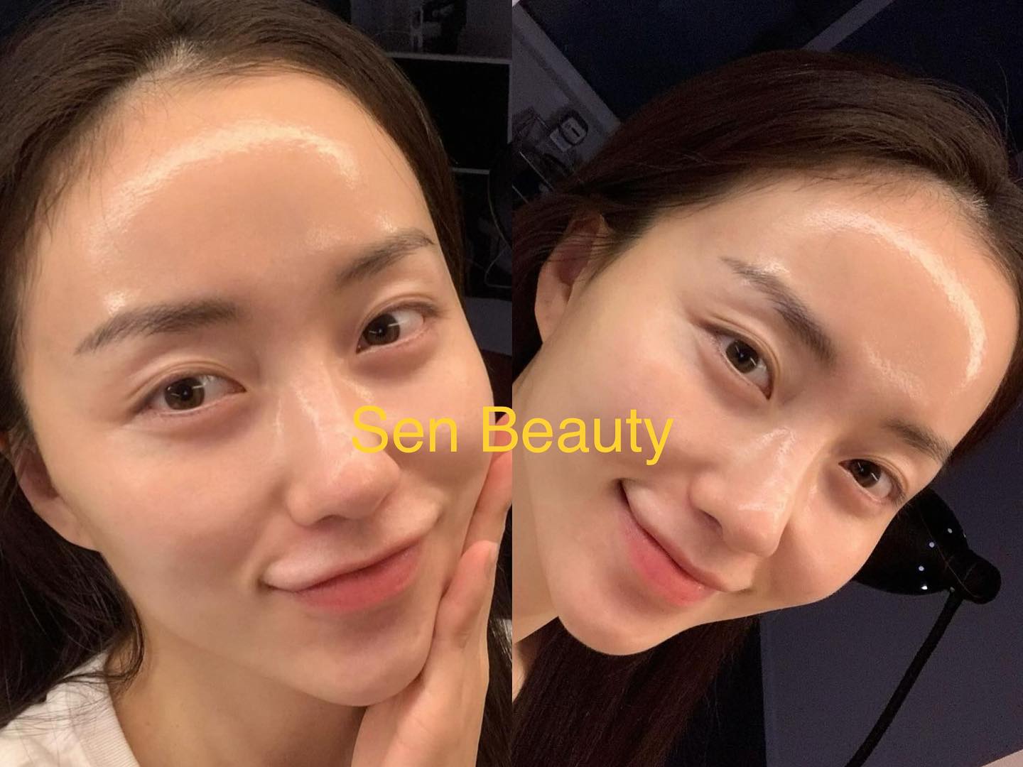 Sen Beauty Facebook ad: Filler - Botox - Thread lifting - Skin…