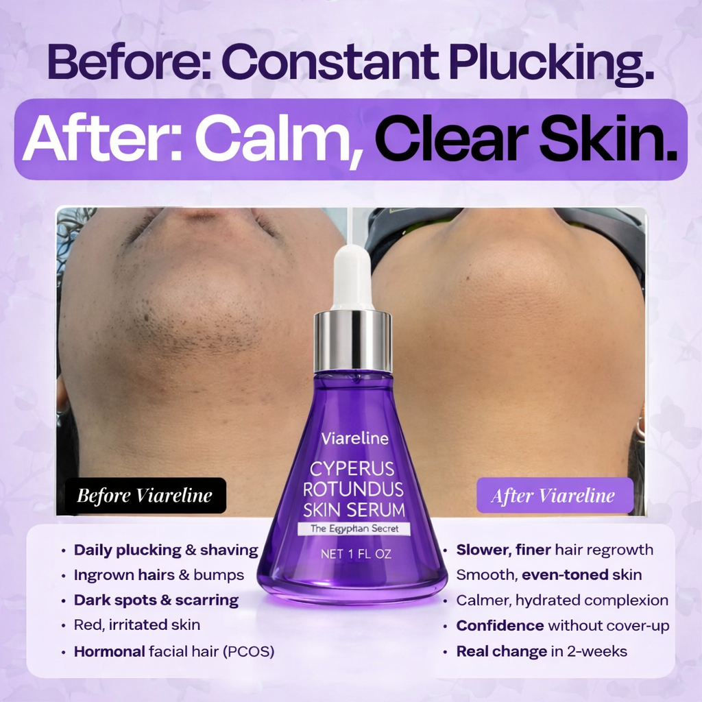 Syvara Facebook ad: Tired of the PCOS 'Chin-Shadow'? Thin it out naturally.