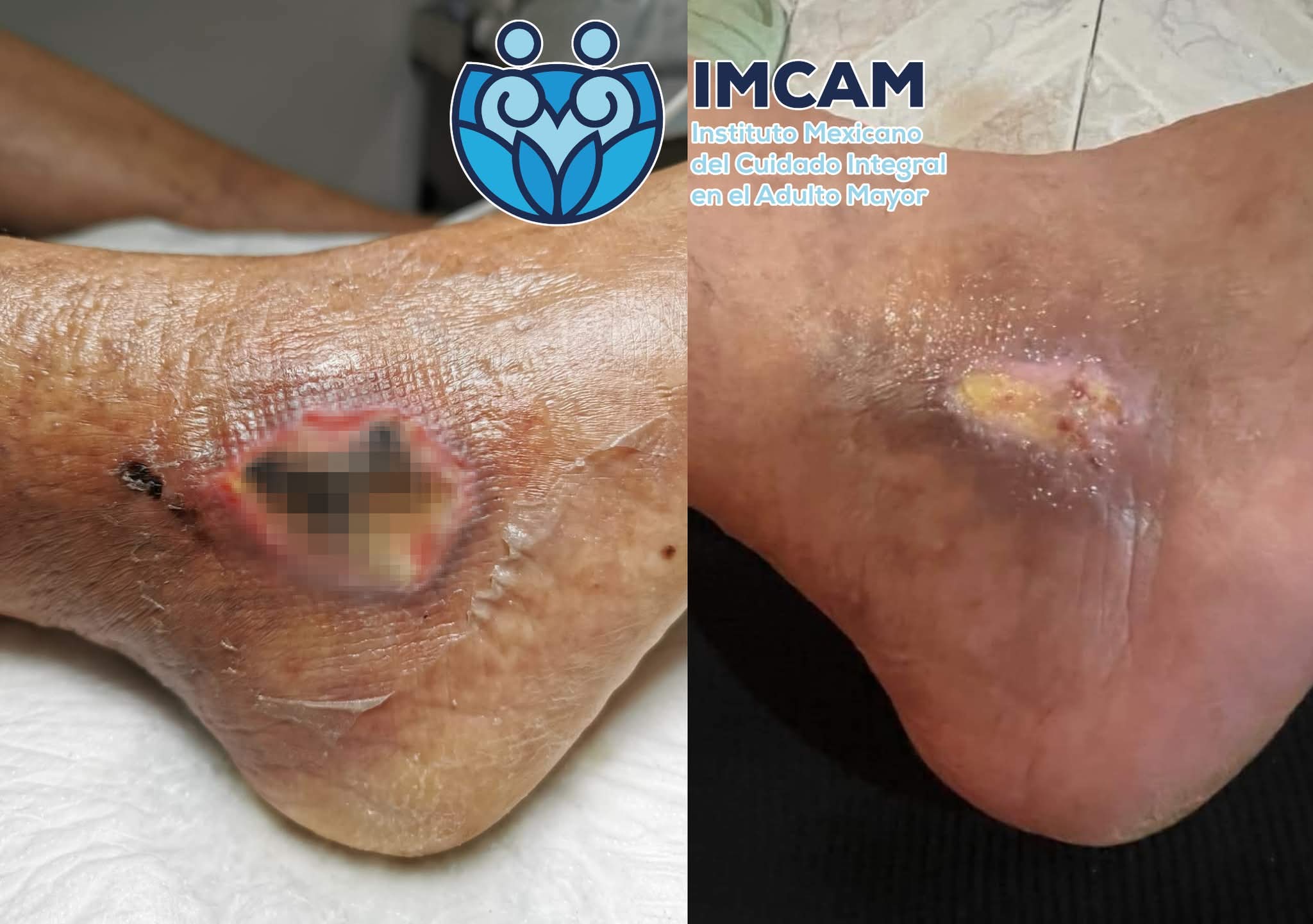 IMCAM Ci-Cura Facebook ad: Estamos en Boca del Río