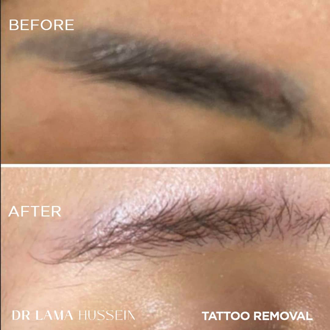 Dr. Lama Hussein Facebook ad