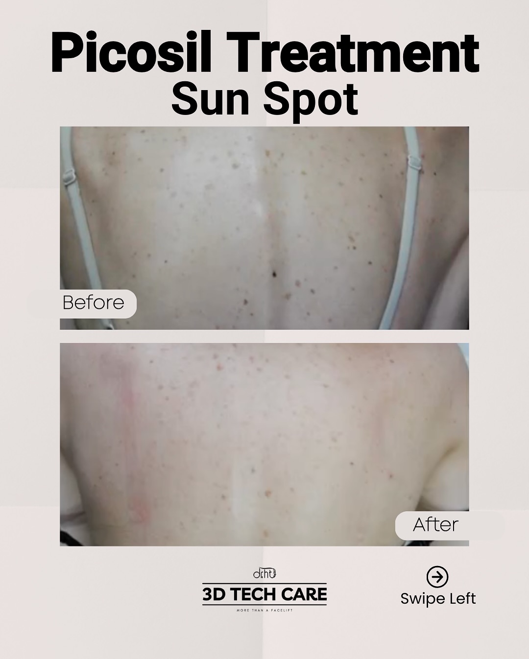 Dr. Hüseyin Tırman - Medical Aesthetic Facebook ad