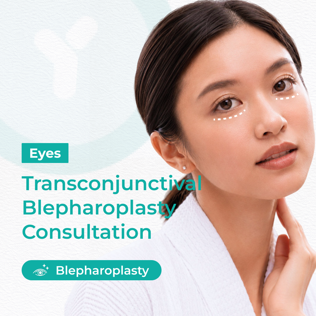 YOO Plastic Surgery and Aesthetics Clinic Facebook ad: Explore blepharoplasty consultation options at YOO Clinic…