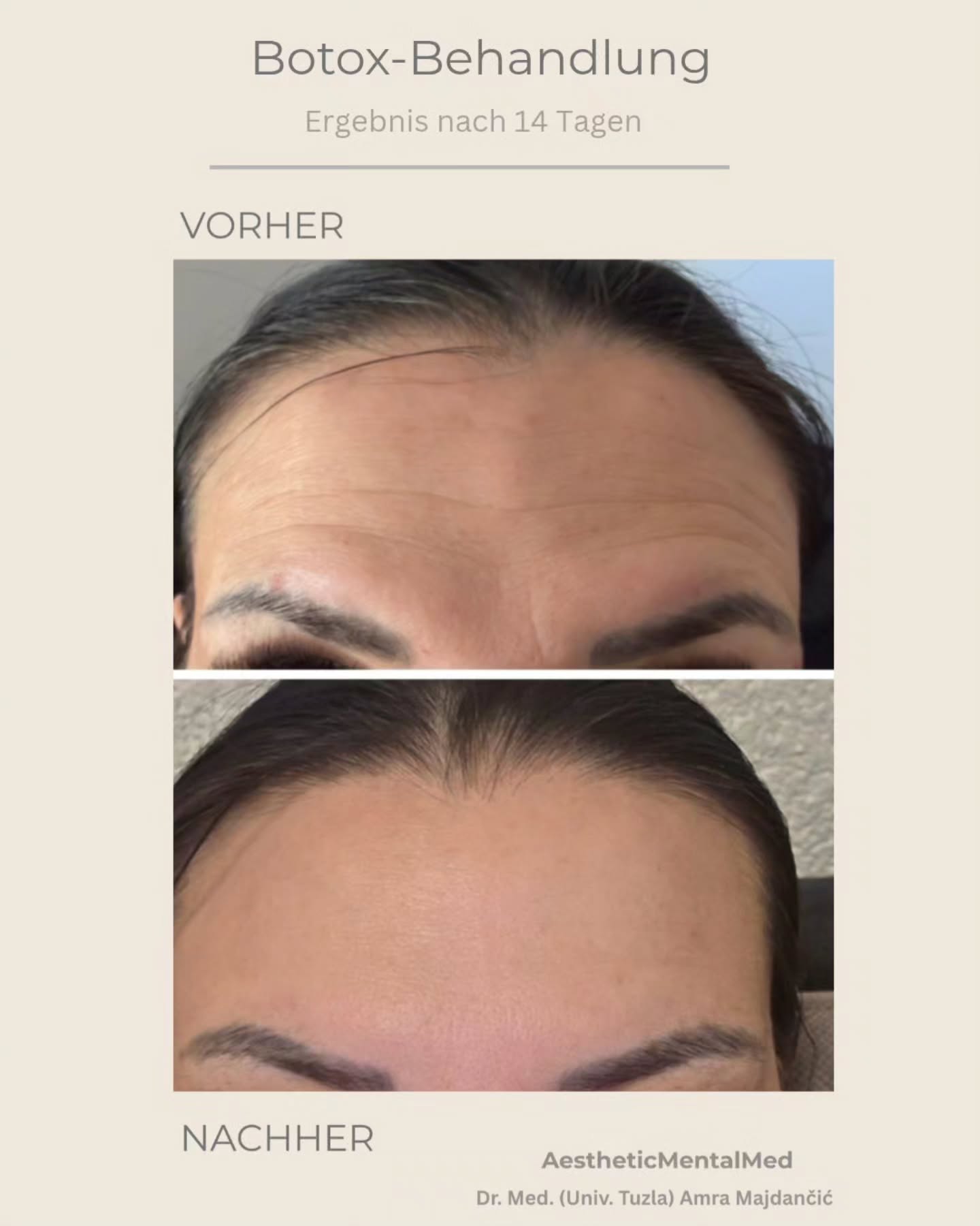 Aesthetic Mental Med Facebook ad: Sanfte, natürliche Ergebnisse nach nur 14 Tagen…