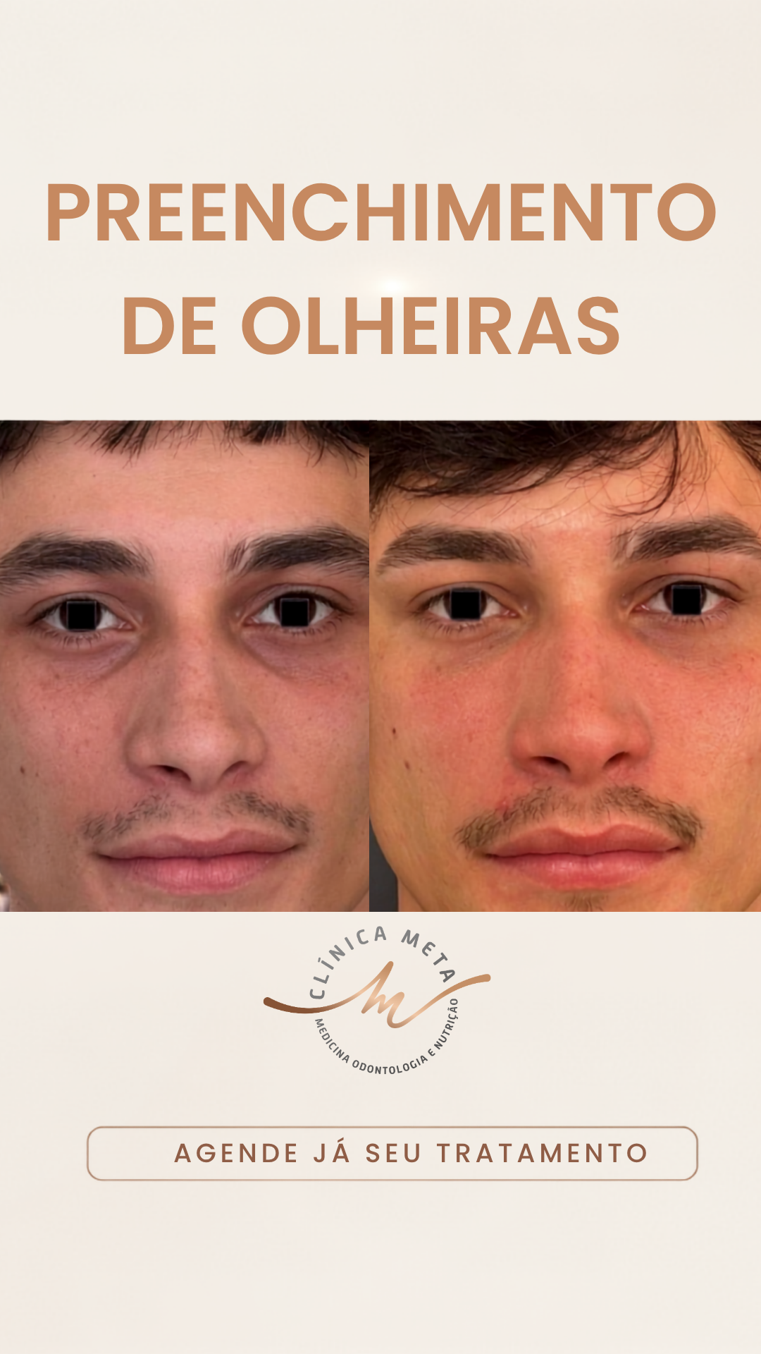 Clínica META - Medicina Integrativa e Estética Facebook ad from Jul 7, 2026