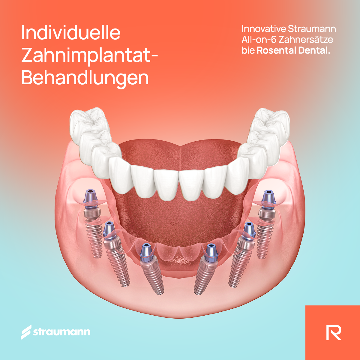 Rosental Dental Facebook ad