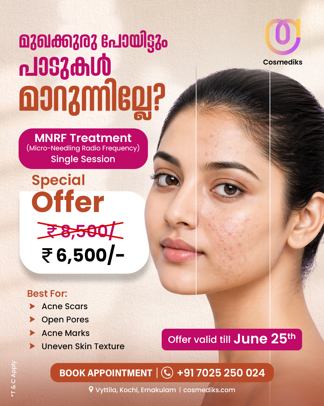 Cosmediks Facebook ad: Flat ₹2000 OFF on MNRF Treatment.