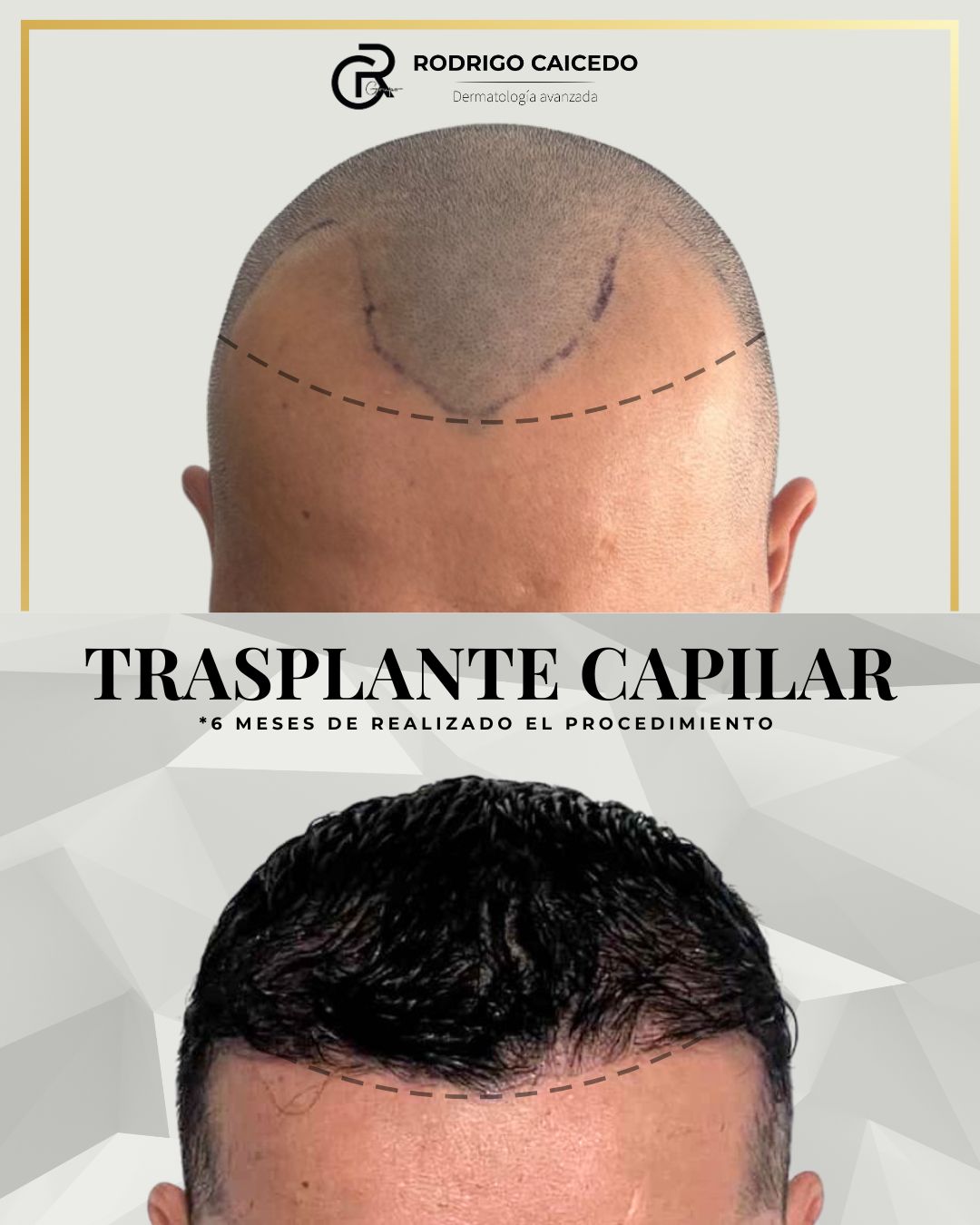 Dr. Rodrigo Caicedo Facebook ad from Dec 1, 2025
