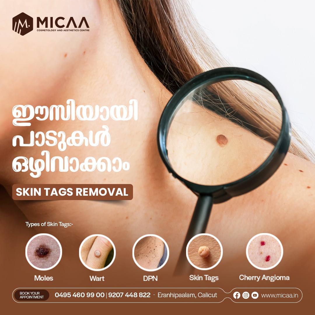 Micaa_calicut Facebook ad