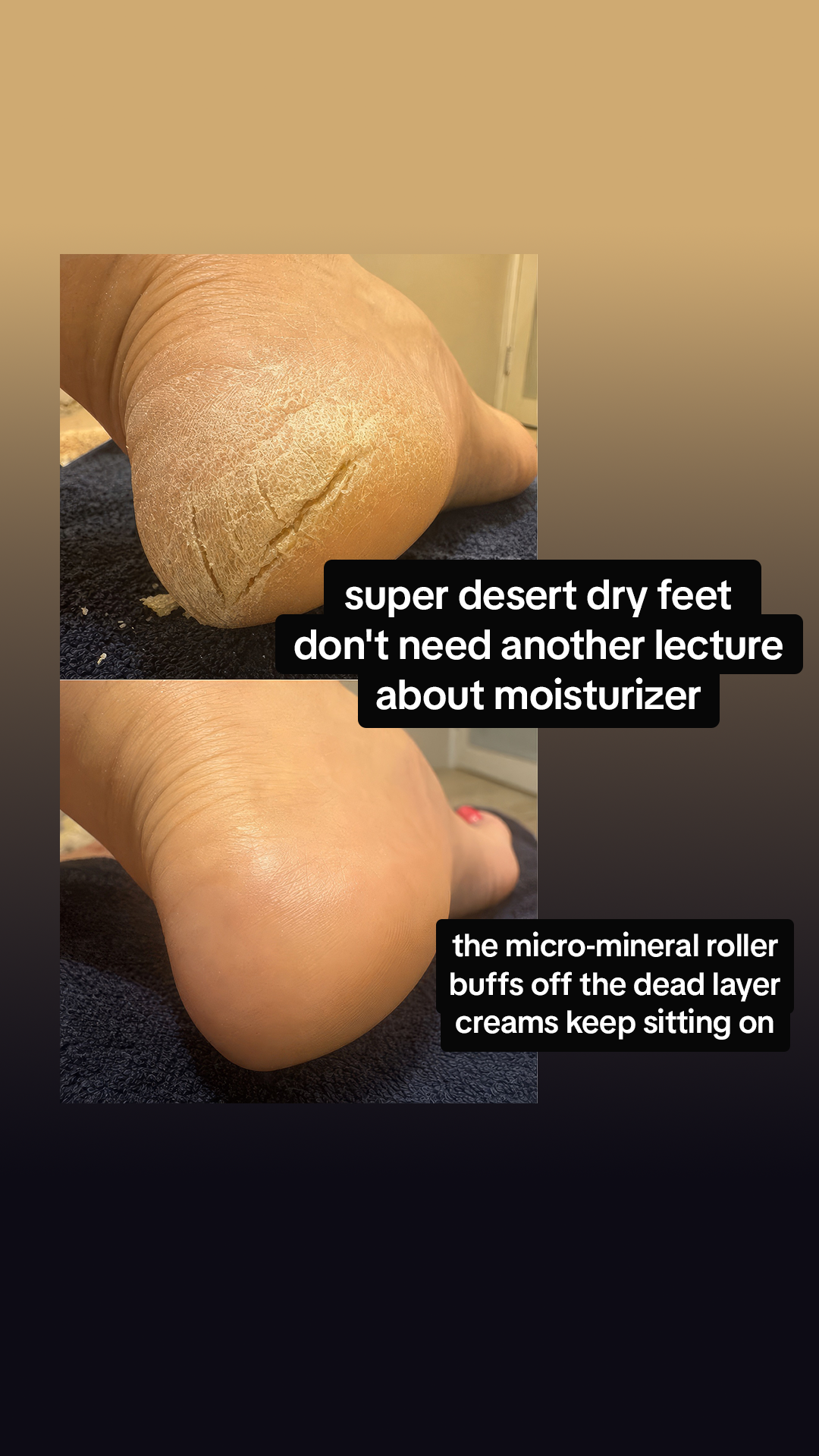 Nuvé Facebook ad: Baby soft feet in 5 minutes flat