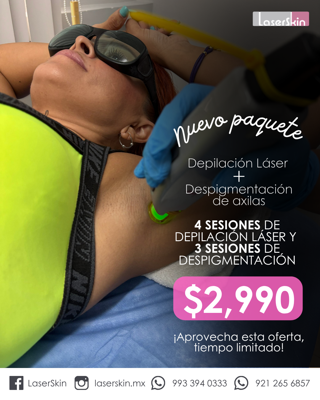 LaserSkin Facebook ad