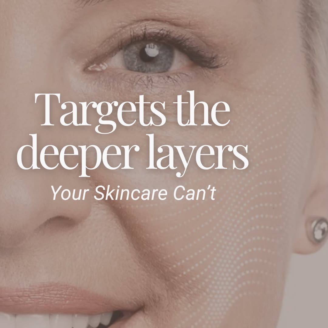 Of Skin and Wellness Facebook ad: Tired of Seeing Deeper Lines Every Year?