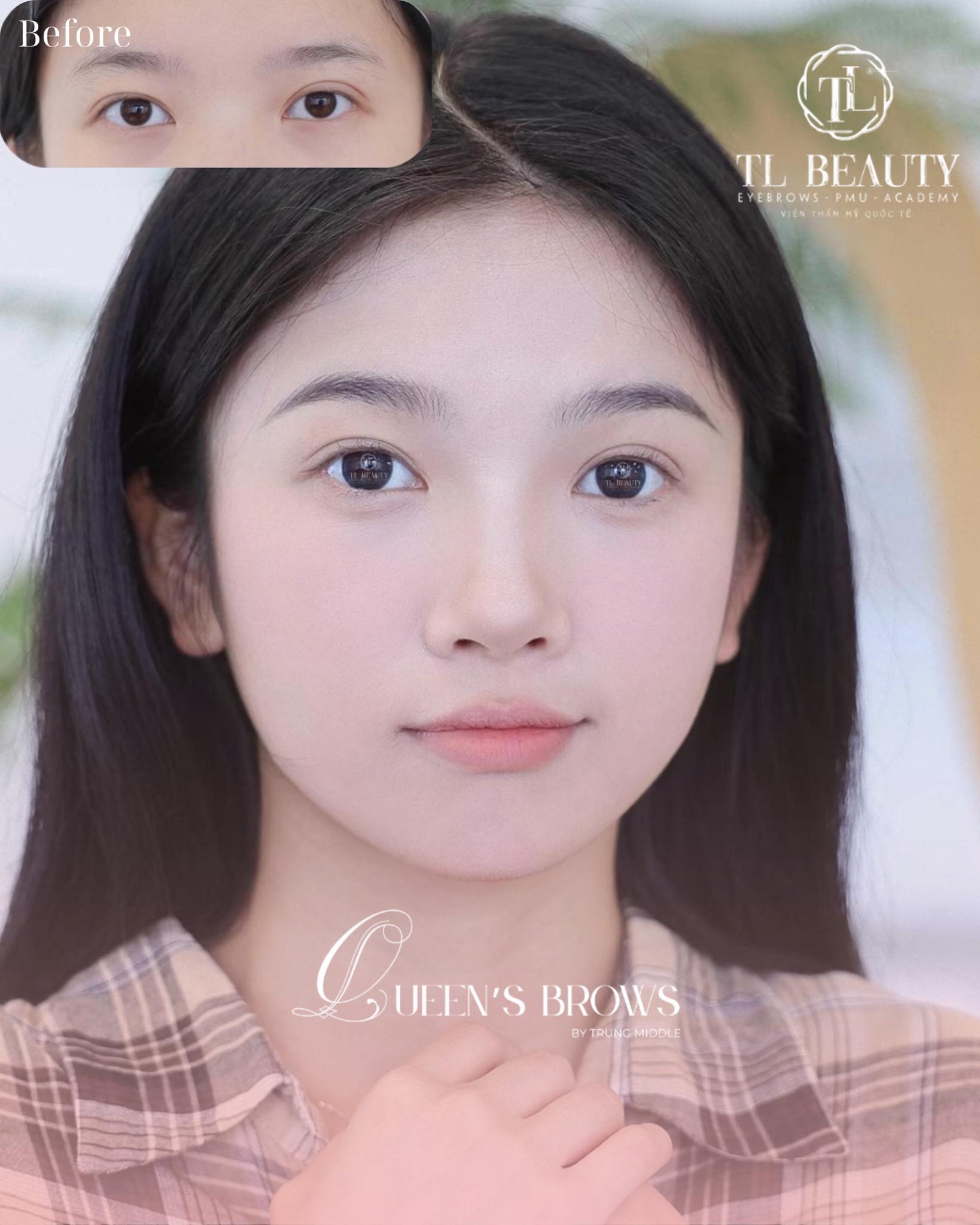 Trung Middle - TL Beauty Center Facebook ad