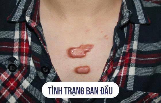 Bs.Nguyễn Huy - Chuyên Khoa Da Liễu HCM Facebook ad