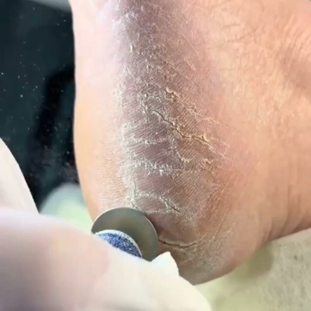 Guldenas Klinik Facebook ad: Medicinsk fotvård från 490 kr + tillgång till den senaste…