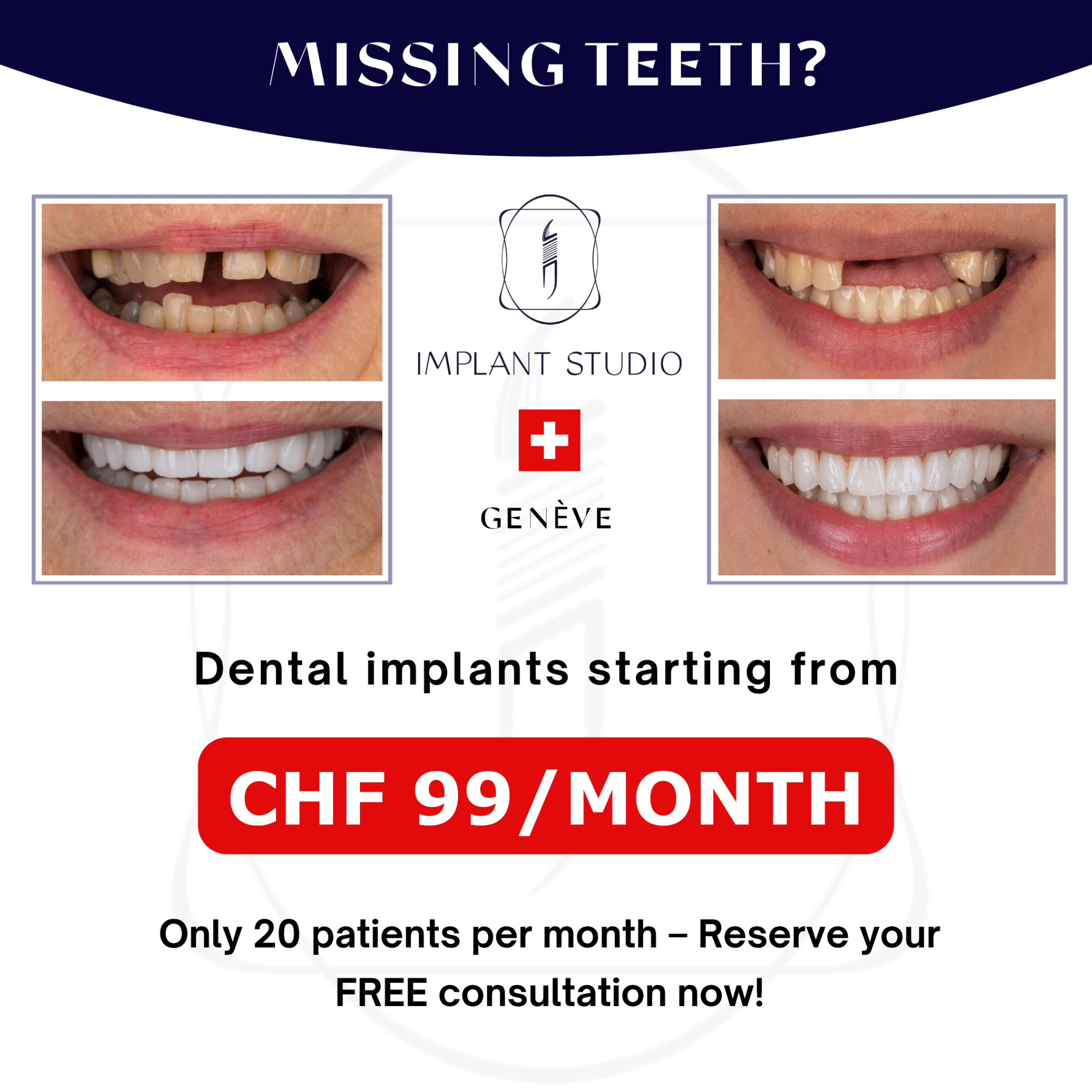 Implant Studio Facebook ad: Dental Implants at CHF 99