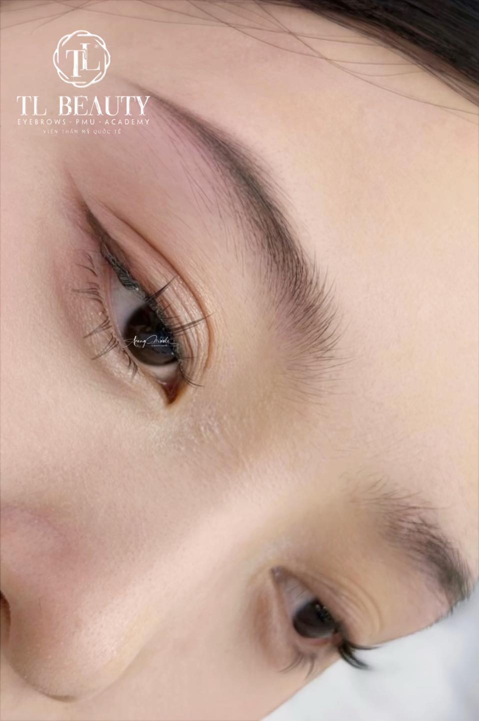 Trung Middle - TL Beauty Center Facebook ad