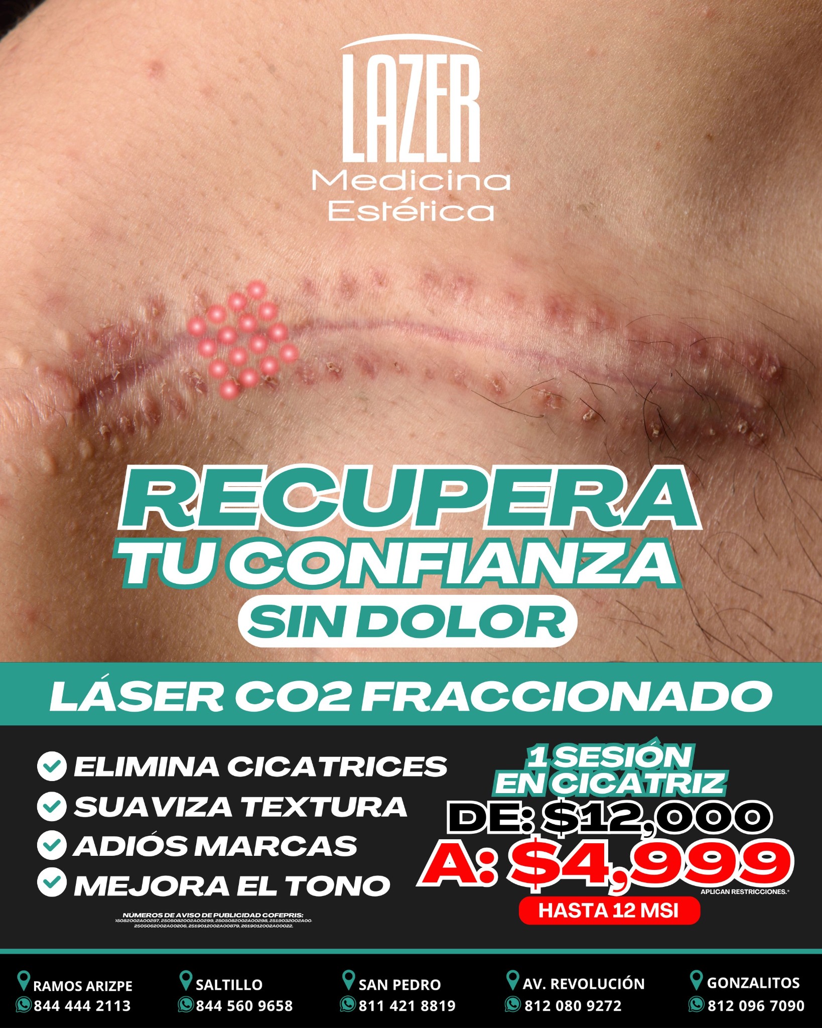 Lazer Medicina Estética MX Facebook ad