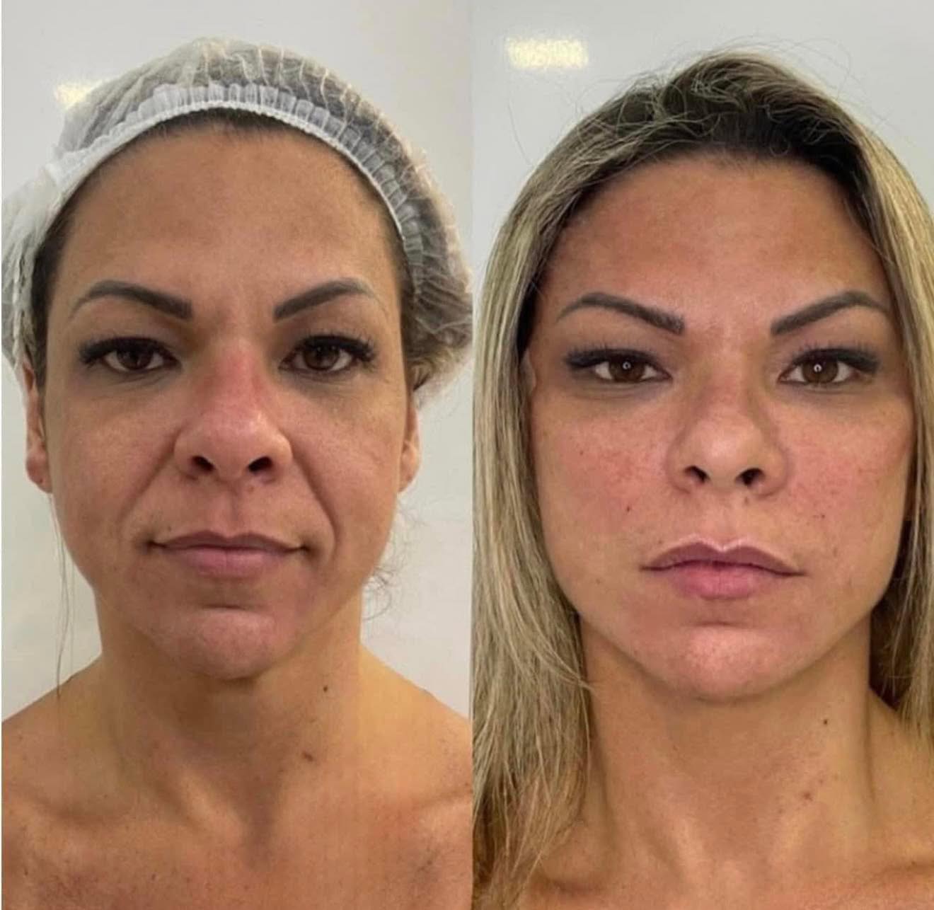 Clinica spa arte cuerpo  Facebook ad