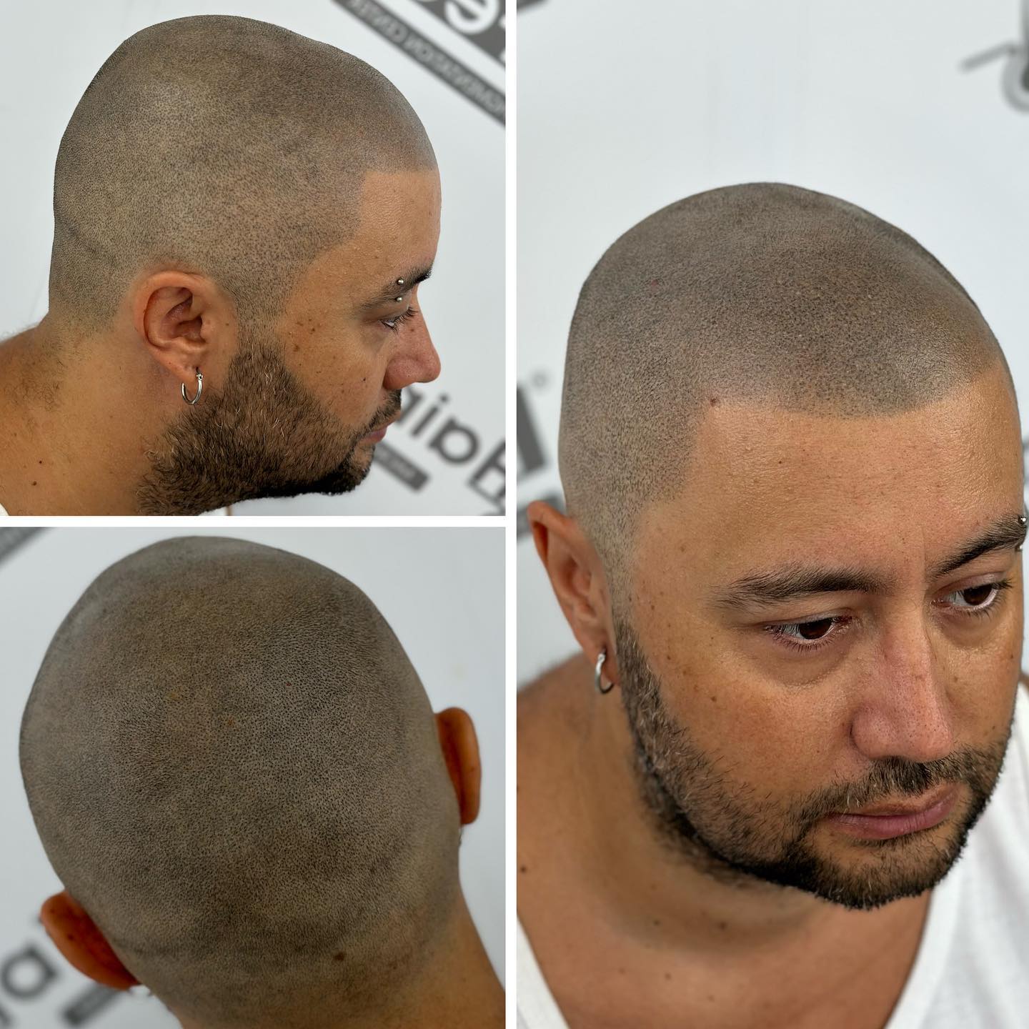 Hair Feel Micropigmentation Facebook ad: Saç simülasyonu
