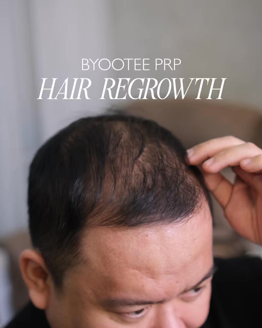 byootee Lounge Capitol Hills QC Facebook ad: Say goodbye to thinning hair, Message Now>>