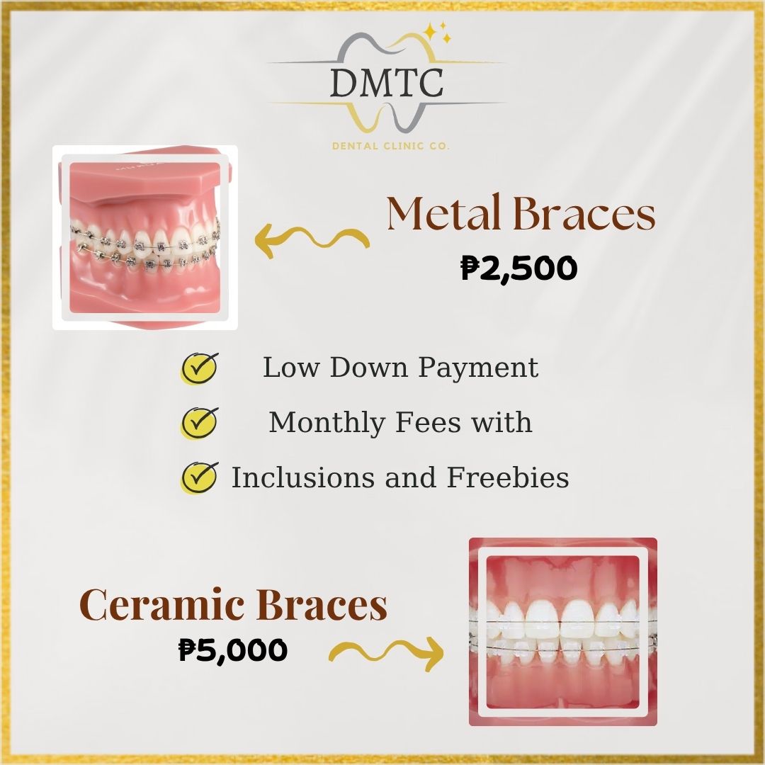 DMTC Dental Clinic Facebook ad: Enjoy exceptional, top-quality services with our exciting…