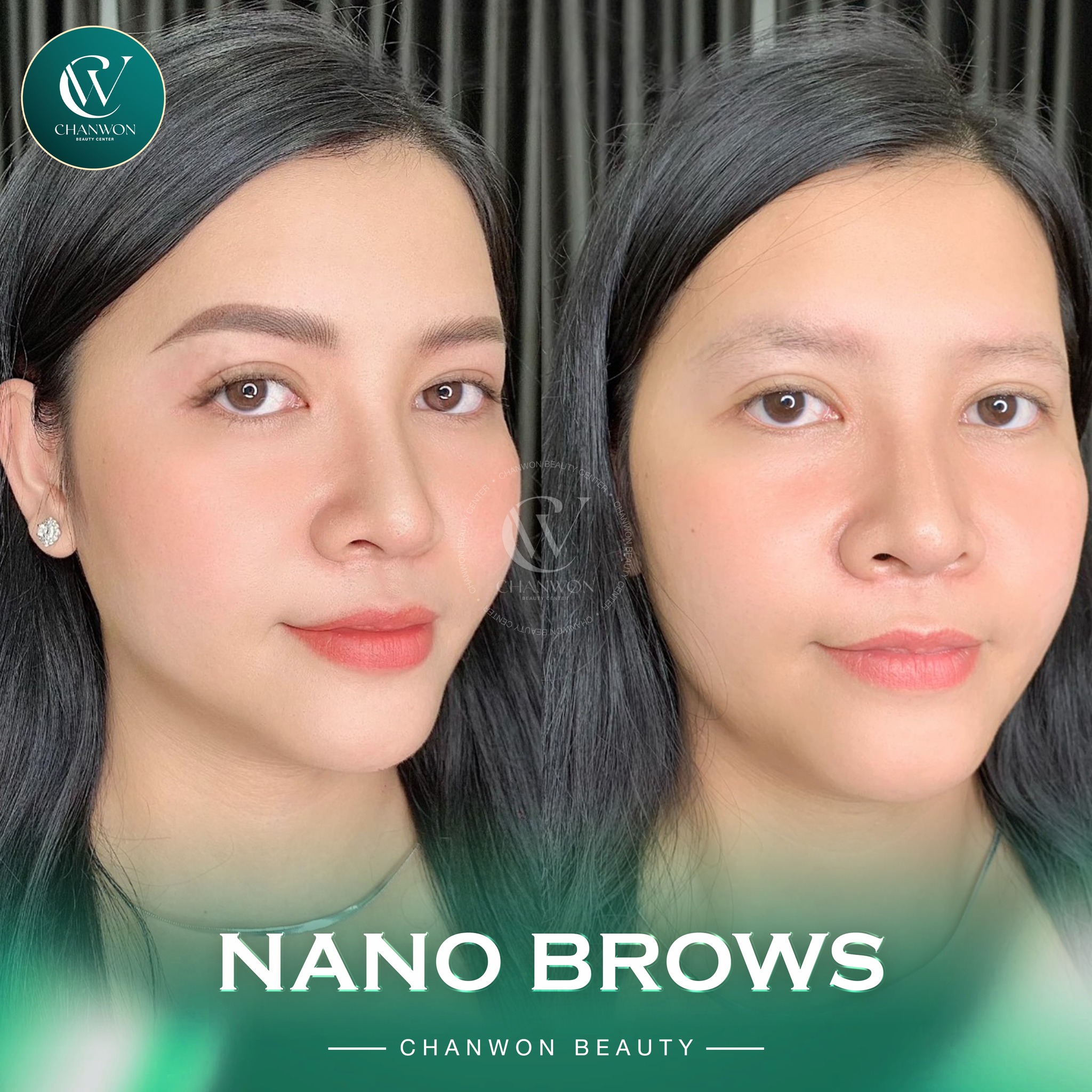 Chanwon Beauty Clinic - Quezon Facebook ad: Soft in the front, bold at the tail…