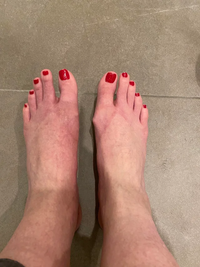 Tyler Reeves Facebook ad: Type 2 Diabetics With Tingling Feet: Read This