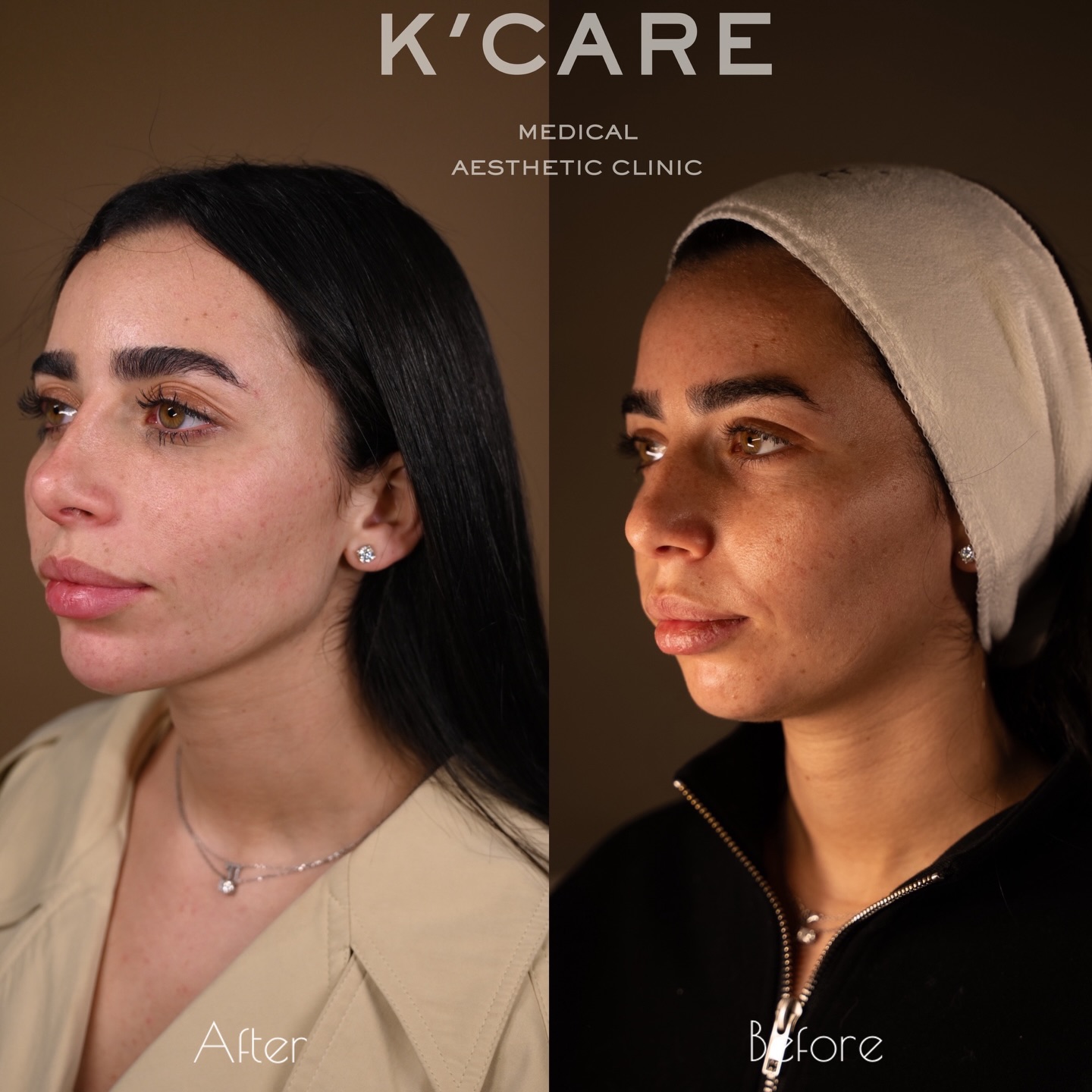 K-care. Facebook ad: פנים שמדברות איזון לא הזרקות החליקו שמאלה לכל…