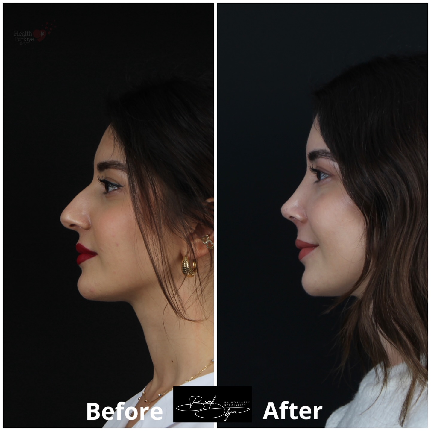 Opdrburakolgun Facebook ad: An incredible transformation at just the second week…