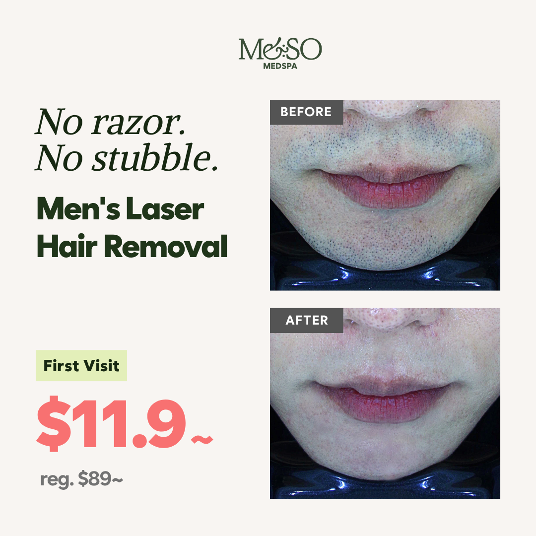 MESO MedSpa Facebook ad: Skip The Razor