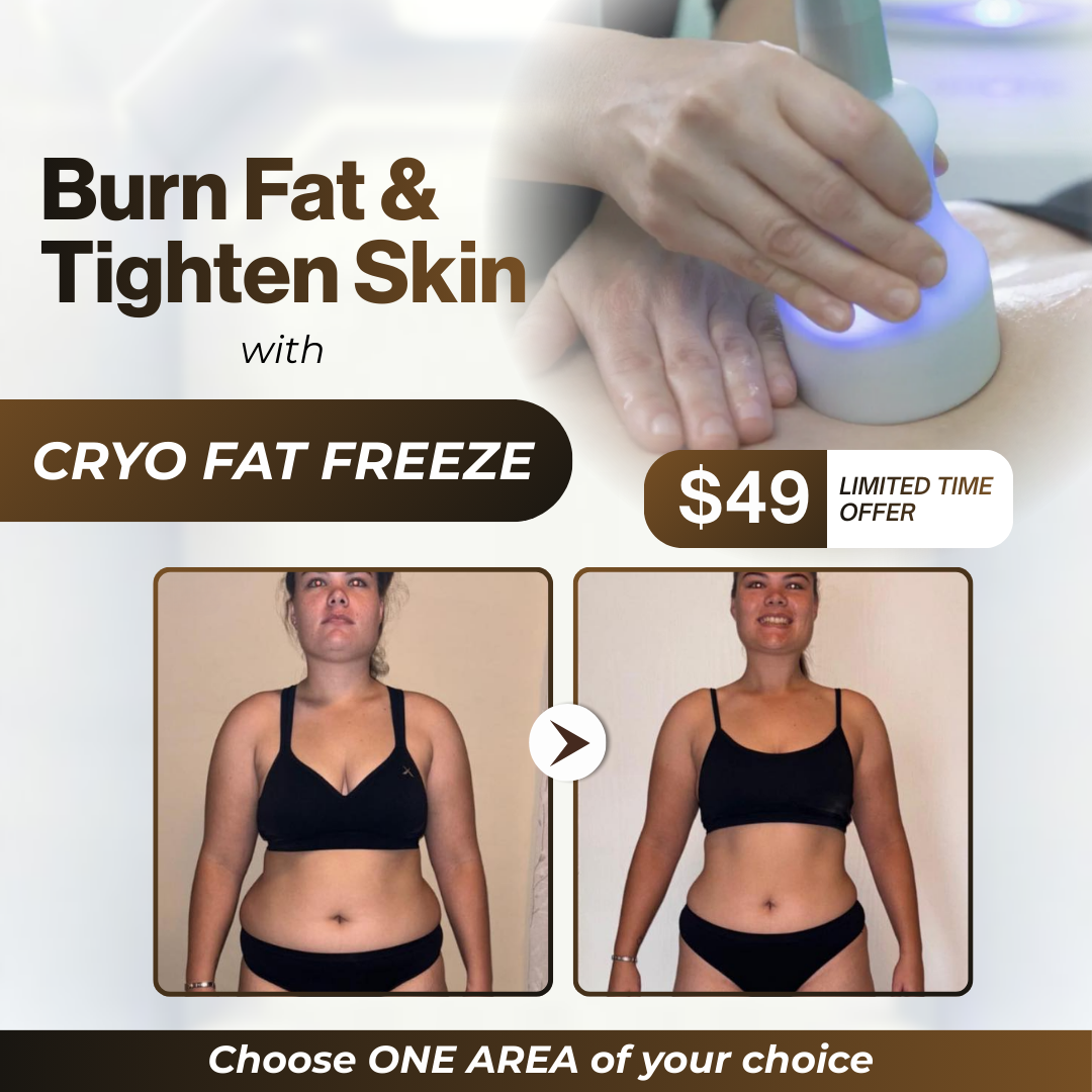 I Love Skin Treatments Facebook ad