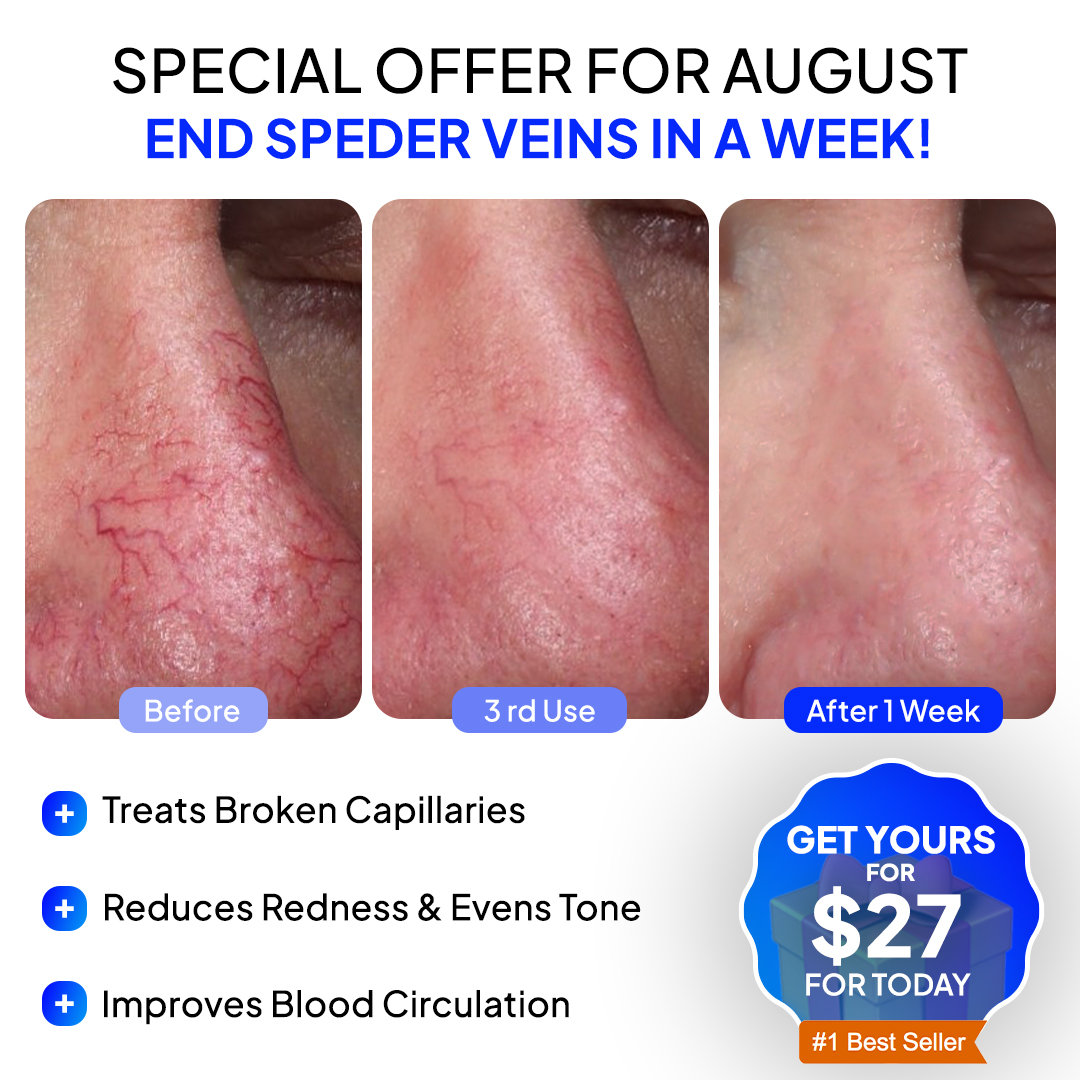 Anti-Redness US Facebook ad