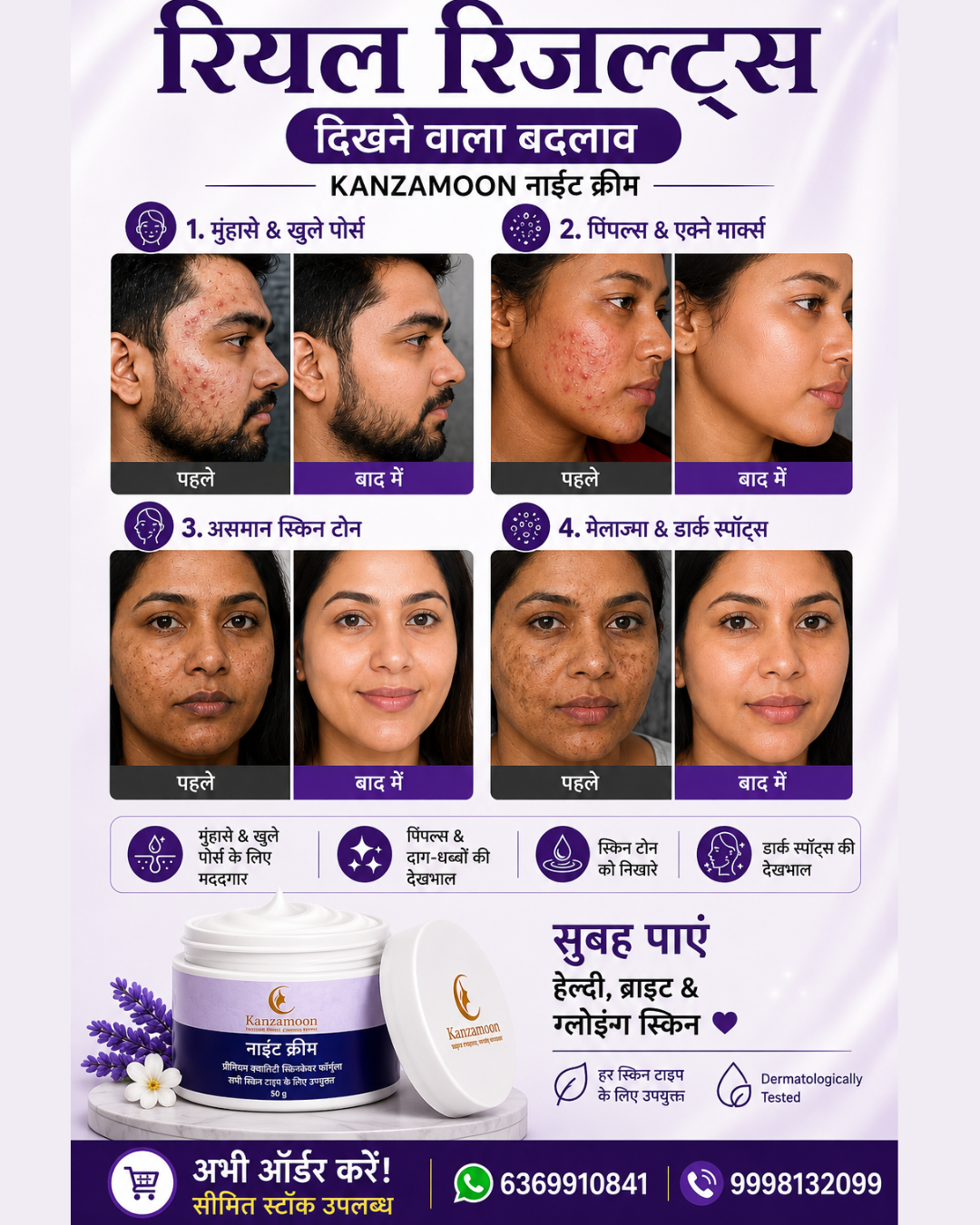 Kanzamoon Beauty Facebook ad: Limited Time Offer, Order Today!