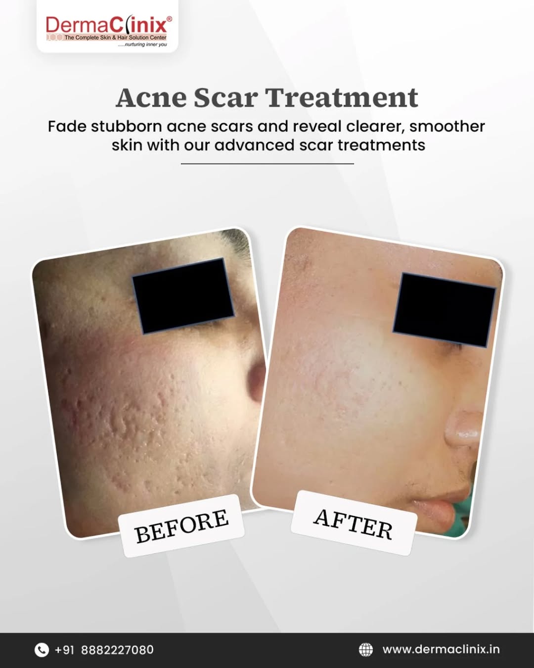 DermaClinix-The Complete Skin and Hair Solution Center Facebook ad