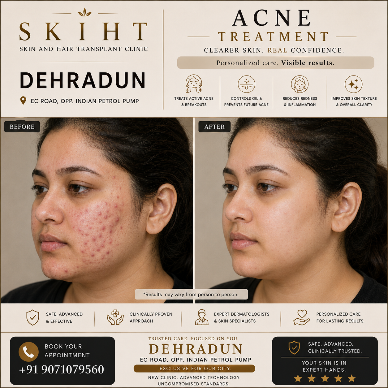 SKIHT - Skin & Hair Transplant Clinic Dehradun Facebook ad: SKIHT - Dehradun's #1 Skin & Hair Transplant Clinic…