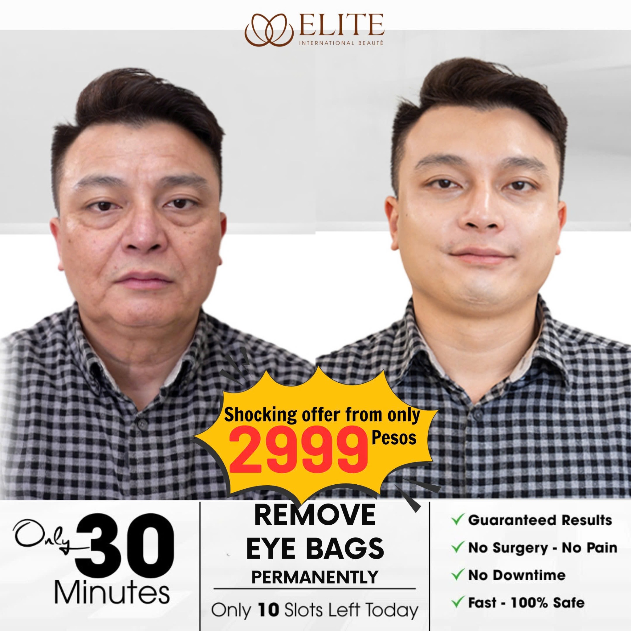 ELITE-Korean Beauty Technology Facebook ad: LOOK 10 YEARS YOUNGER FOR ONLY 2999