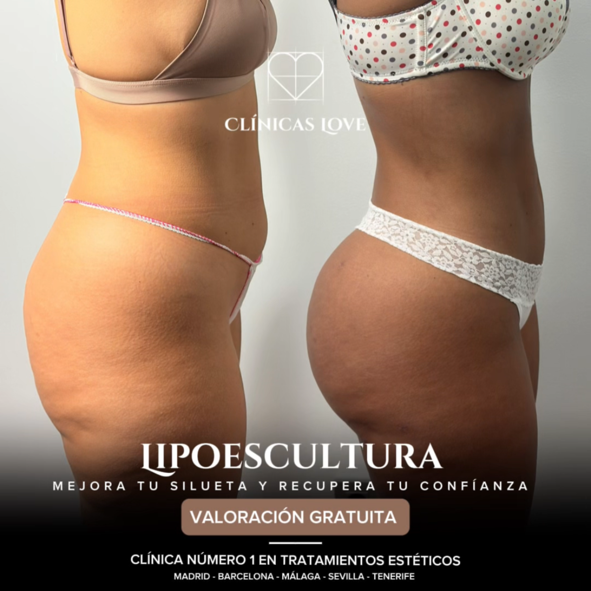 Clínicas Love Málaga - Cirugía y Medicina Estética Facebook ad: Mejora tu contorno corporal